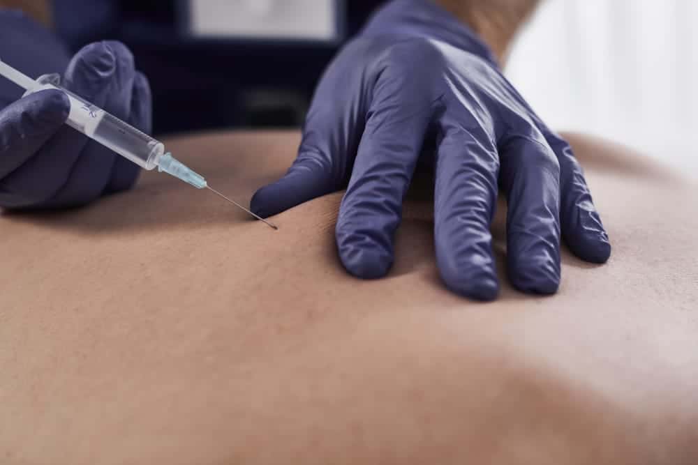 Epidural Steroid Injections Can Help Relieve Your Pain After a