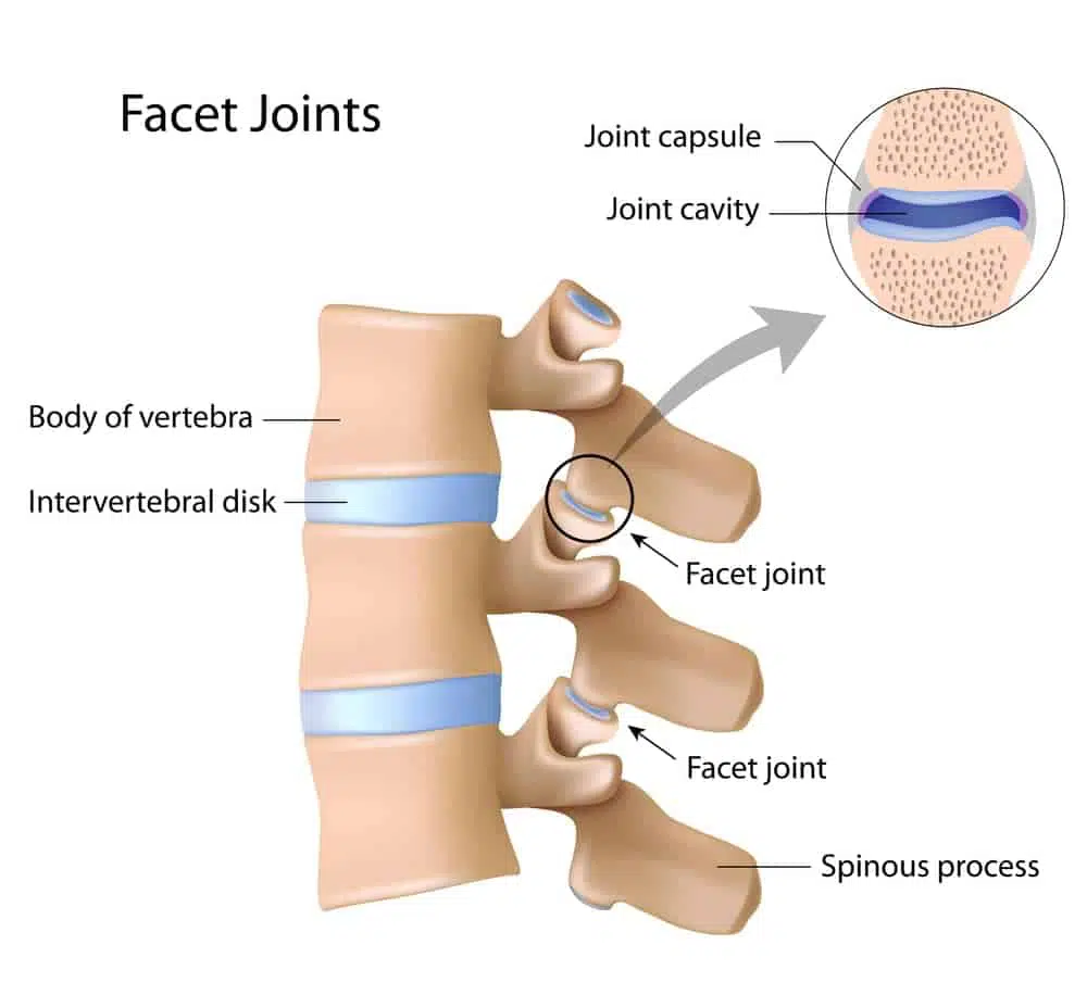Facet joint injection treatment in Torrance