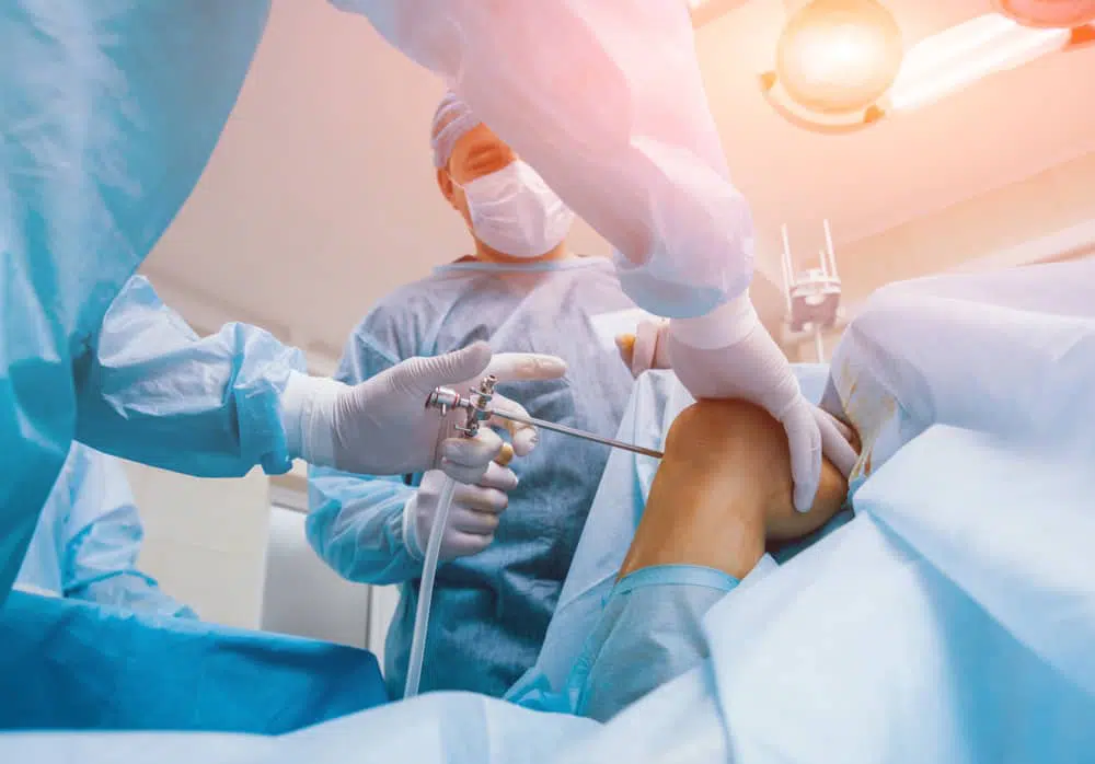 Arthroscopic knee surgery in Torrance.