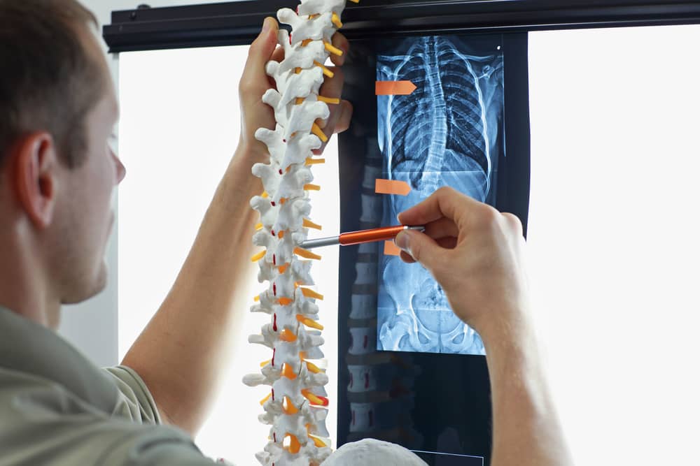 Doctor holds of spine and points to a disc disorder.