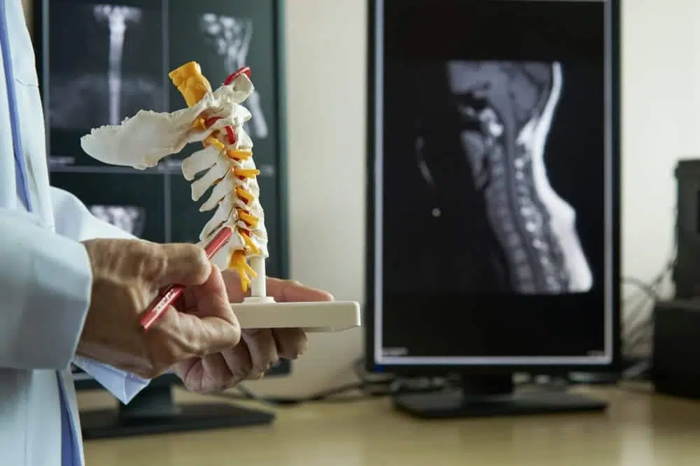 Doctor holds neck spine model to show patient about neck pain