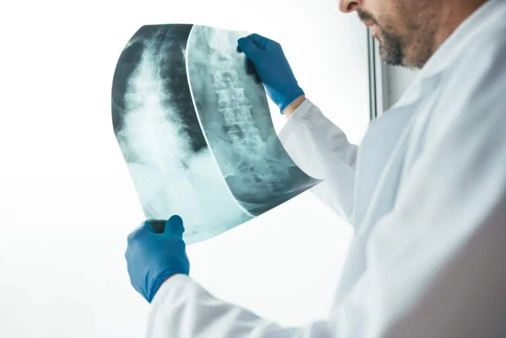 Doctor looking at patient x-rays.