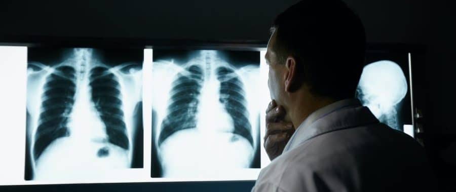 doctor looking at x-rays