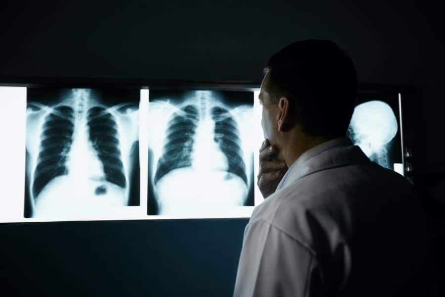 Doctor looking at patients back x-rays