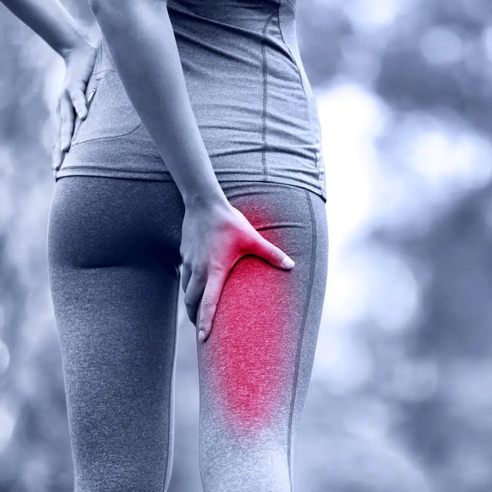 Sciatica leg pain in a female runner.