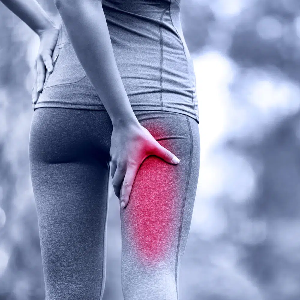 Sciatica Basics - Fix My Pain