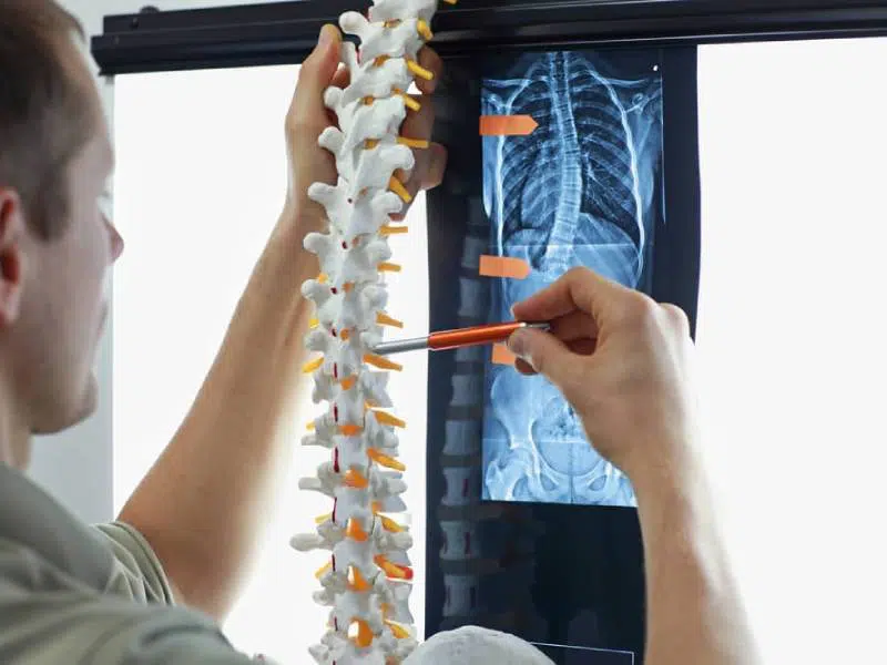 Doctor holding a back spine model preparing for back surgery.