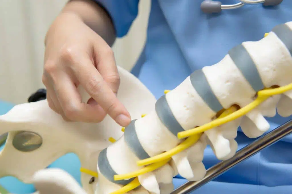 Types of Spine Surgeries from a Torrance Spine Surgeon