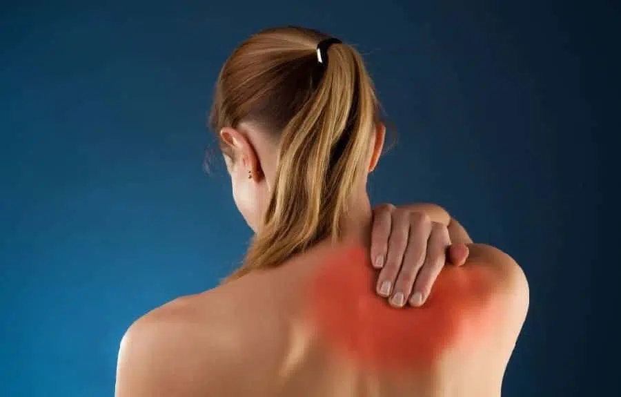 myofascial pain syndrome